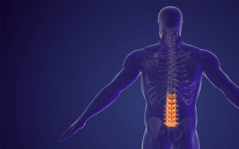 ¿Qué tipos de dolor de espalda pueden presentarse tras una cirugía bariátrica?